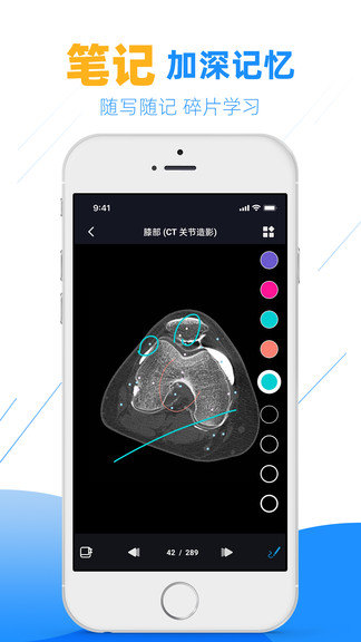 影像解剖图谱 影像解剖图谱