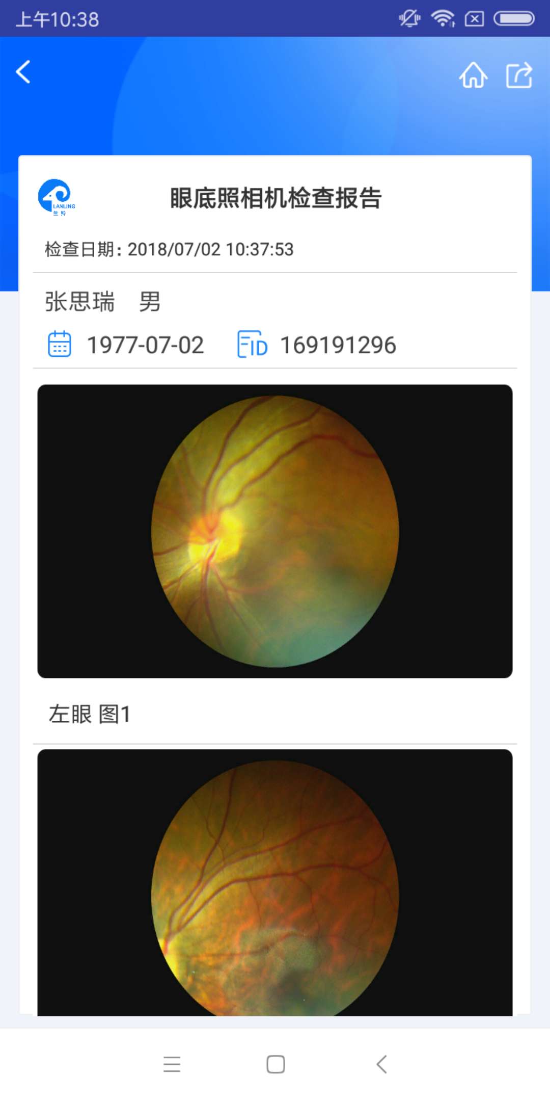 KJ眼底相机