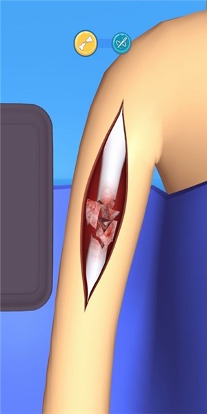 Surgery Master(外科手术大师)