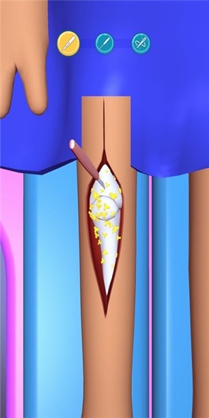 Surgery Master(外科手术大师)