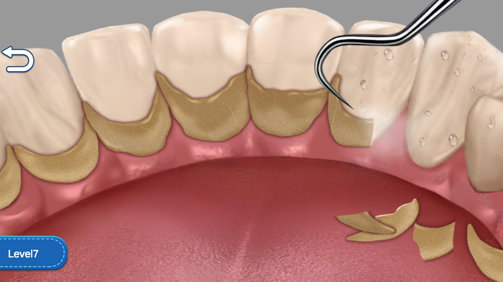 清洁牙齿狂热(Clean Teeth Craze)
