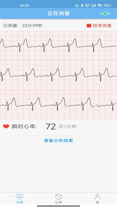 数维康心电