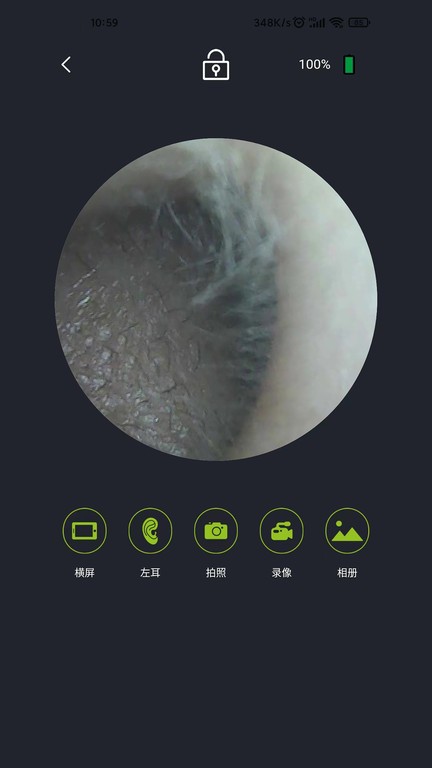 米螺采耳